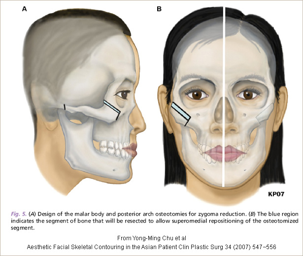 Our Services Introduction Plastic Surgery Asan Medical Center Our Services Introduction Plastic Surgery Asan Medical Center